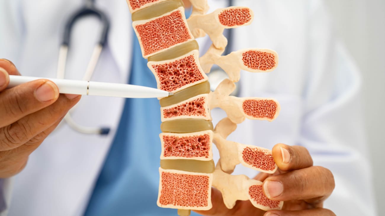 Osteoporosis