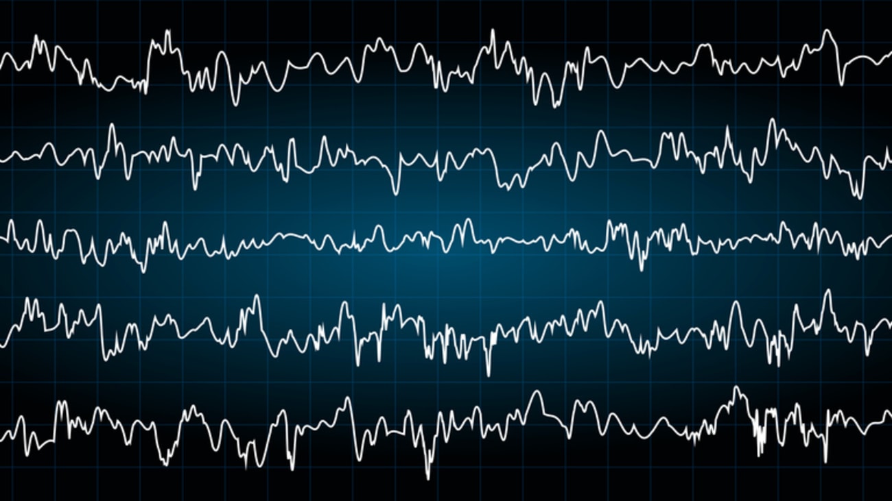 EEG