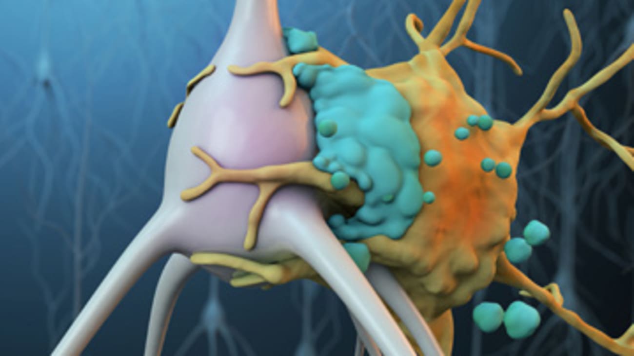 A microglial cell (yellow) attached to an ischemic neuron (gray) that has been tagged by complement proteins (blue).