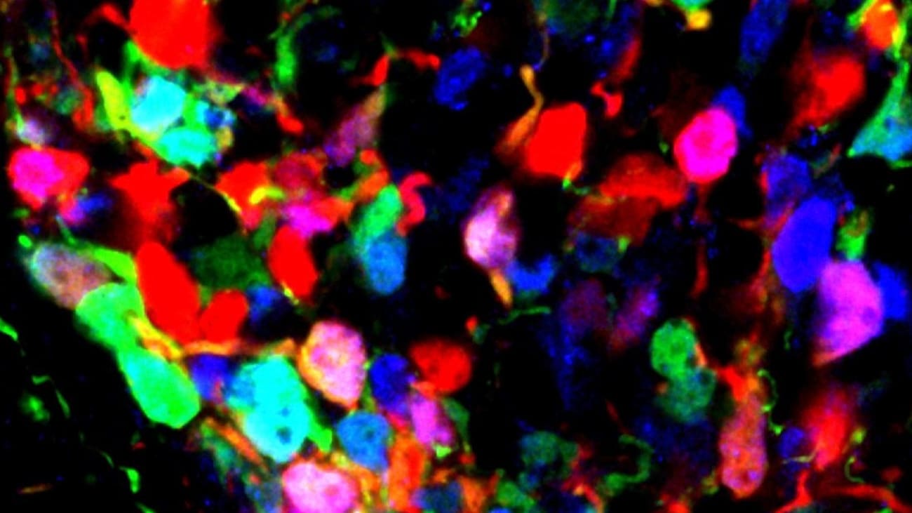 This microscopy image shows developing mouse hypothalamic tissue. Red marks POMC neuronal precursors, blue marks protein expression of the transcription factor Otp, and green marks prospective adult AgRP neurons. The image captures a developmental transition in which a subset of POMC precursors begins to express Otp as they adopt an adult AgRP neuronal identity. UT Southwestern researchers discovered that this switch may influence susceptibility to obesity.