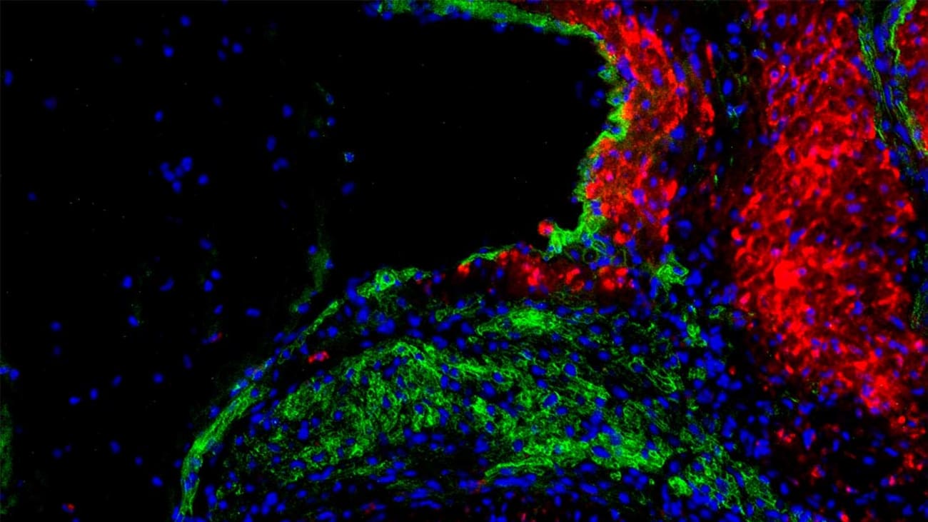 The mouse atrioventricular (AV) node. Green staining indicates AV node cells, while red staining highlights neighboring atrial muscle cells. All cell nuclei are stained blue.