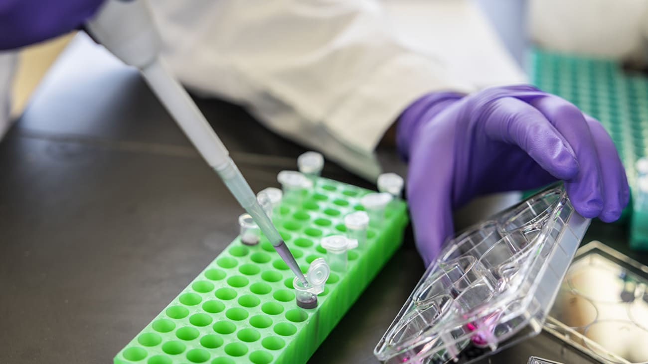 Clinical Lab hands working with pipet