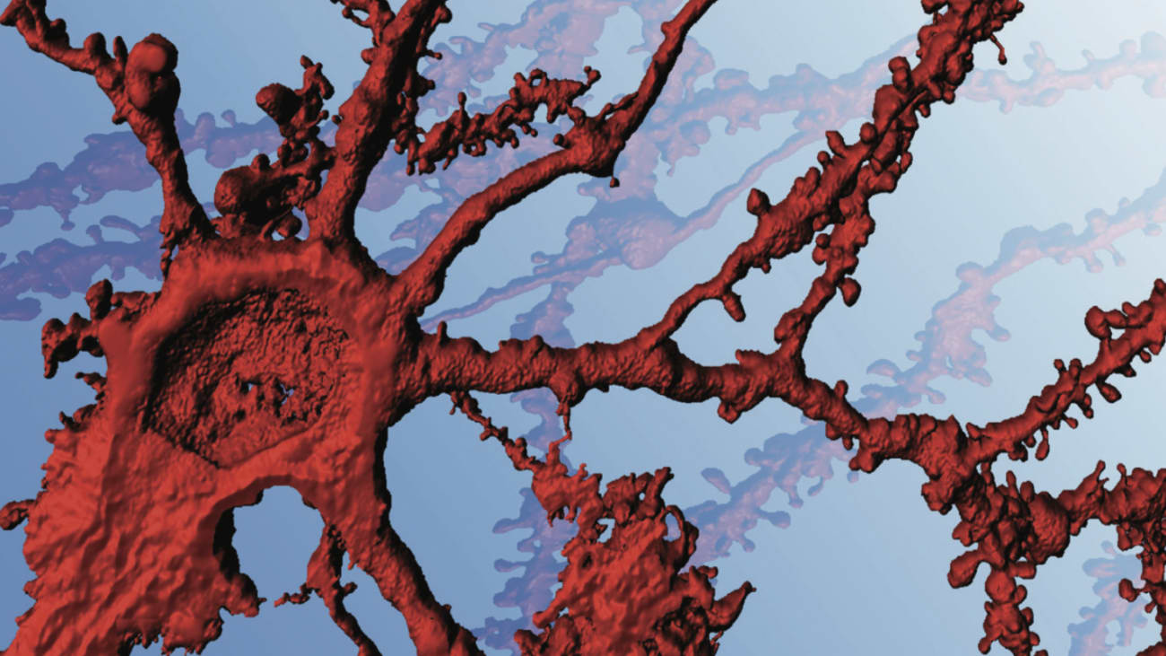 Image of neuron courtesy of Jennifer Cho, an M.D./Ph.D. student in Cowan’s laboratory. Image acquired from a confocal microscope that was funded through an S10 Shared Instrumentation Grant Program (OD021532).