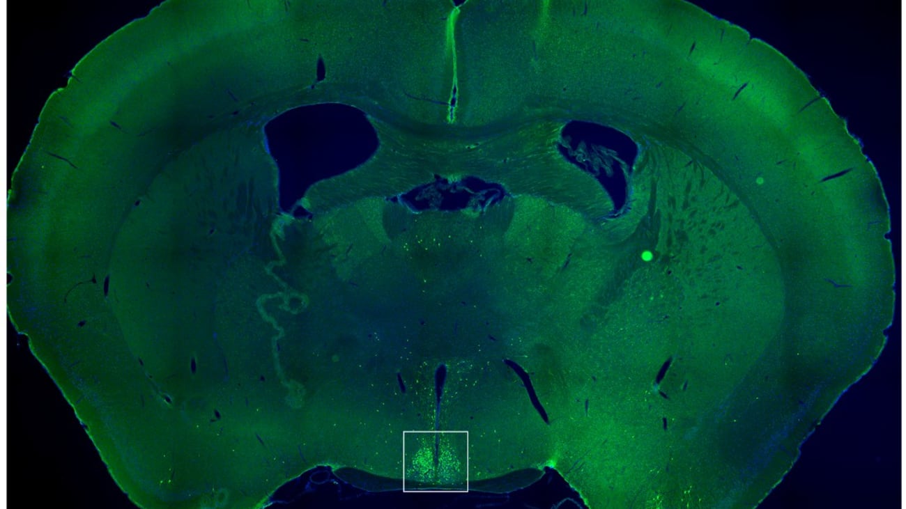 This image shows a thin slice from the middle of a mouse brain, with the region known as the suprachiasmatic nucleus (SCN) surrounded by a white box. The small green dots mark brain cells that react to the hunger hormone ghrelin. When the ghrelin-sensitive cells in the SCN are turned off during the mouse’s normal rest time, the animals snack less and lose weight.