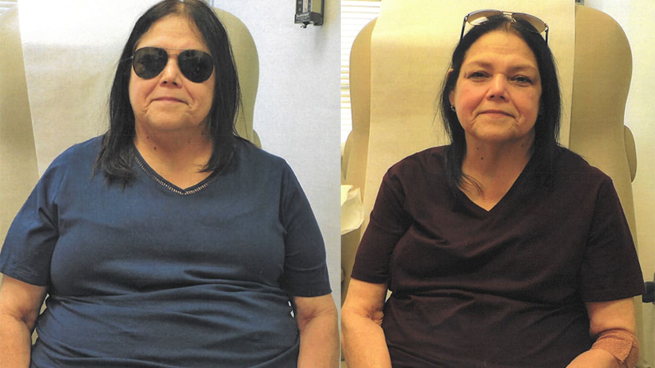 One participant in the STEP 2 clinical trial, Vickie Sanchez, lost 60 pounds over 18 months while taking the weekly injectable medication semaglutide. The above pictures were taken before (left) and at the end of her trial period.