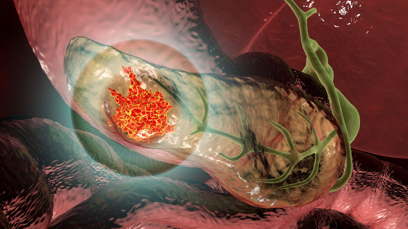 Pictured above are pancreatic cancer cells (nuclei in blue) growing as a sphere encased in membranes (red). Image by Min Yu, USC Norris Comprehensive Cancer Center, Pancreatic Desmoplasia