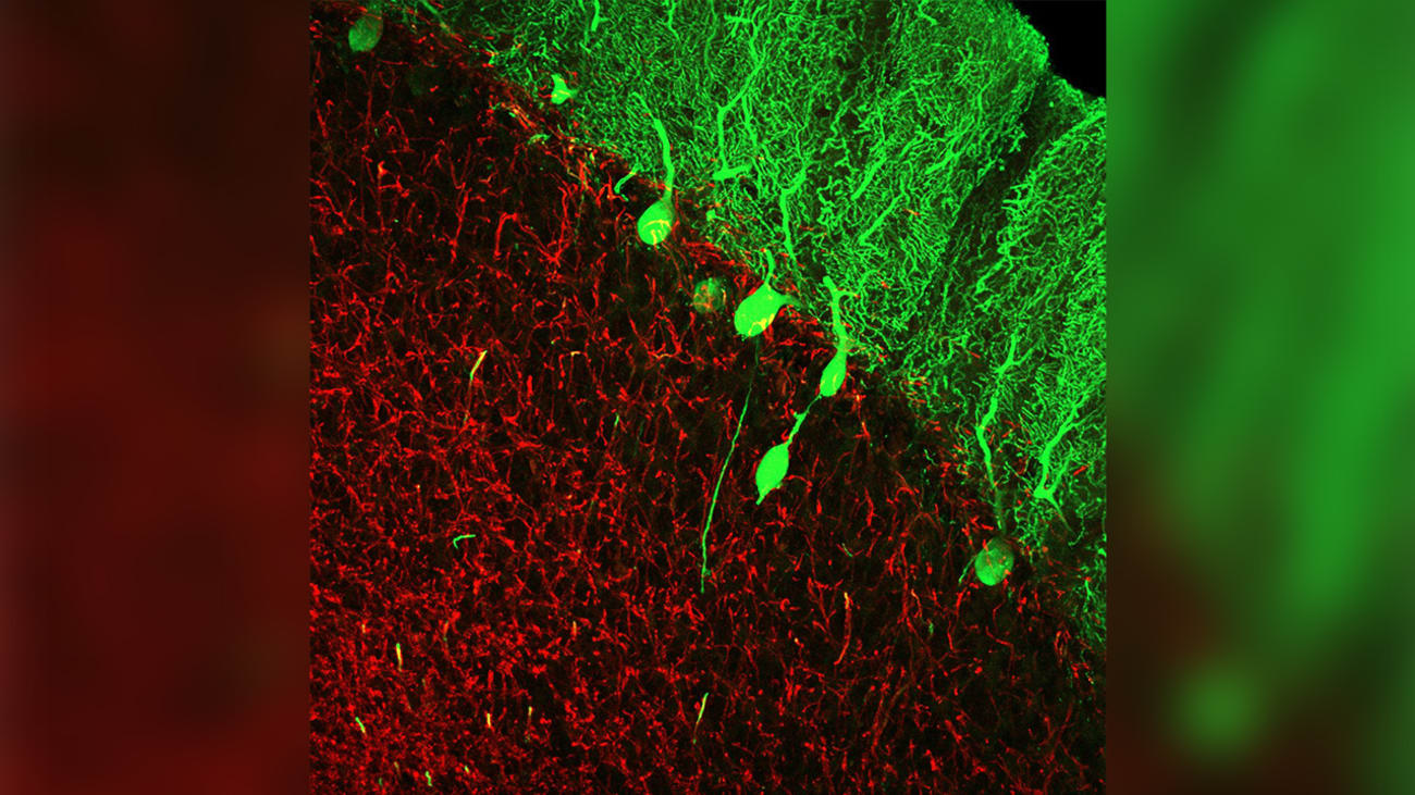 Changes in the brains of patients with essential tremor are centered on a group of neurons in the cerebellum known as Purkinje cells, the round and oval green objects in this image.