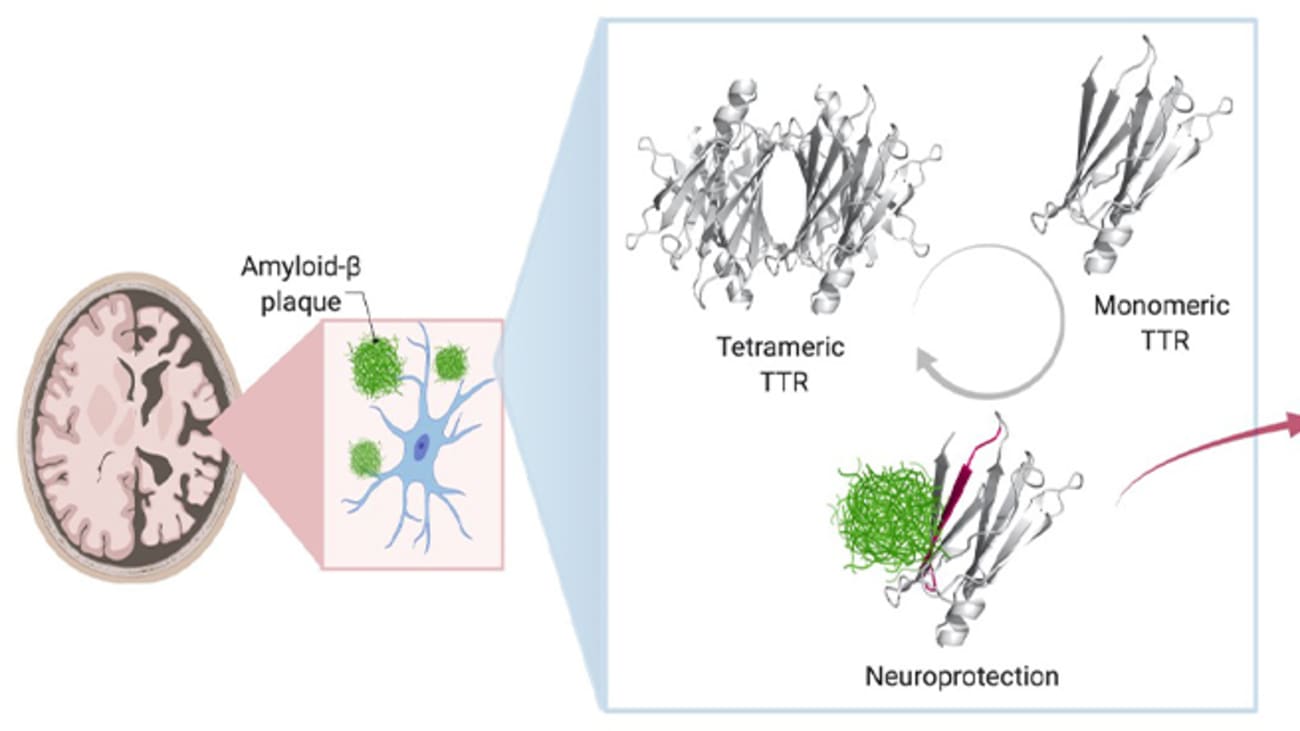 Abnormal deposits of the protein amyloid beta in the brain have been linked to Alzheimer’s disease. The above illustration reveals a potential way discovered by UTSW researchers to stop this process, leveraging the protective nature of the protein transthyretin (TTR) to identify a segment of this protein, TTR-S, that halts plaque formation and facilitates its degradation in a test tube.
Credit: UT Southwestern