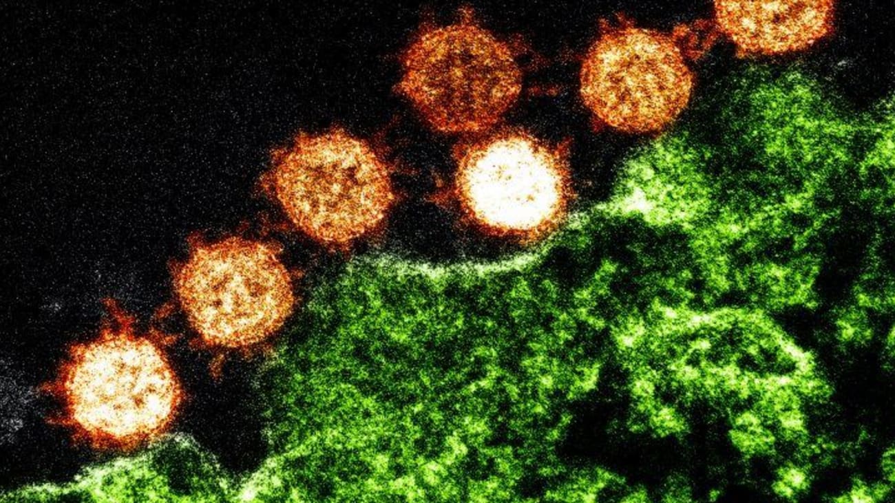 Electron micrograph of SARS virus particles (orange) near an infected cell (green). Like SARS, the new virus from Wuhan is a coronavirus with a crown-like structure. Image credit: NIH