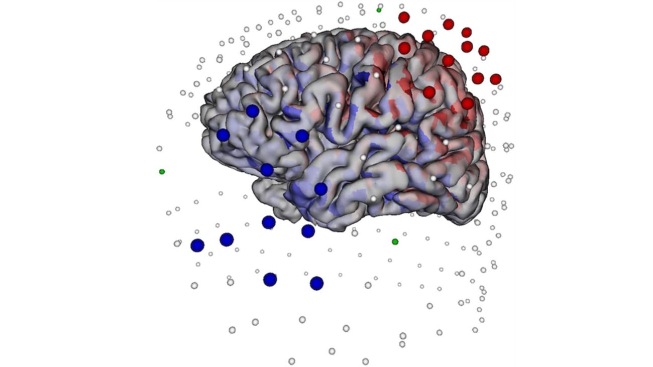 A cloud of source-sink electrodes selected for TES. The 15 large blue electrodes are those selected as cathodes, and the 15 large red electrodes are those selected as anodes. The arrows pointing away from the left anterior temporal lobe represent the cortical patches selected for target spike cluster localization.