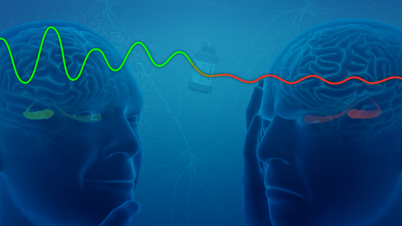 Theta oscillations – brain waves associated with encoding memories – lessen in intensity with administration of a drug called scopolamine, according to a study by UT Southwestern researchers. The findings suggest an area of focus for new therapies for Alzheimer’s disease.