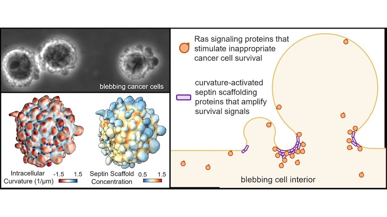 Viewing detached melanoma cells through a light microscope (left, above) reveals cells covered in blebs: small blister-like protrusions of the plasma membrane (left, below). 3D surfaces of blebbing melanoma cells made using advanced lightsheet microscopy and computer vision software allow careful analysis of cell shape and the distributions of different proteins. These surfaces are from the same cell, colored to show either plasma membrane curvature or the concentration of septin scaffolding proteins (right). A cartoon diagram illustrates the central mechanism of bleb signaling.