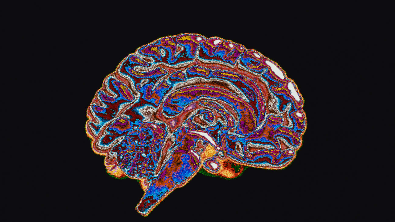Device keeps brain alive, functioning separate from body - UT ...
