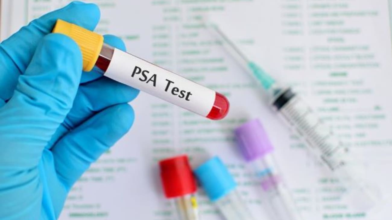 Personalizing Prostate Cancer Screening May Improve the Accuracy of