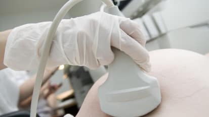 Acute Liver Failure in Pregnancy 