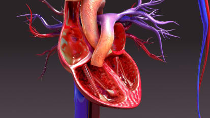 Percutaneous Valve Treatment in 2023