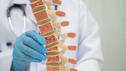 Updates in Osteoporosis Management