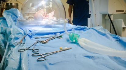 外科肺移植:不作业决策