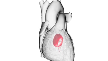 Mitral Valve Anatomy and Echo Evaluation of Mitral Regurgitation