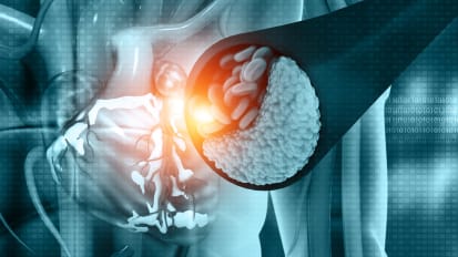 Diagnostic Testing In Coronary Artery Disease