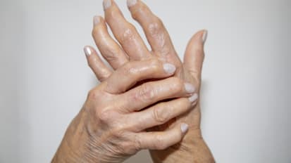 (Cytokine) Storms in our Backyards: Autoinflammation for the General Rheumatologist