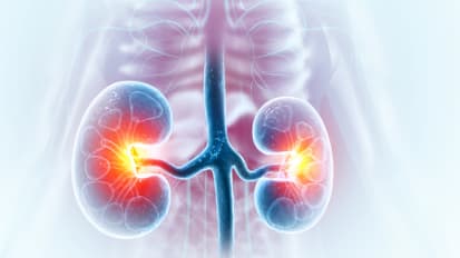 Update in Transplant Medicine: Navigating the Kidney Evaluation Process