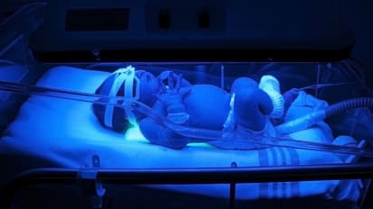 Neonatal Cholestasis
