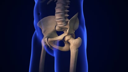 The Hypermobile Hip: Biomechanics, Diagnosis, and Treatment Decision Making: Part 1