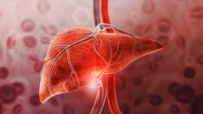 Liver Transplant Allocation: Evolving Toward a Continuous Distribution Model