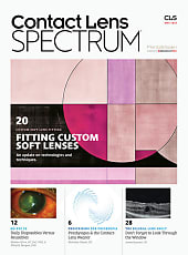 Contact Lens Spectrum