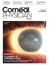 Corneal Physician