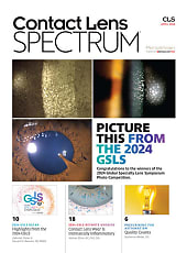 Contact Lens Spectrum