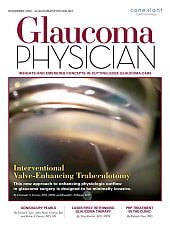 Glaucoma Physician
