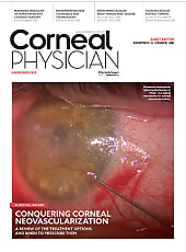 Corneal Physician