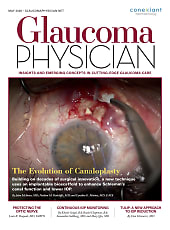 Glaucoma Physician