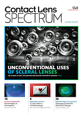 Contact Lens Spectrum