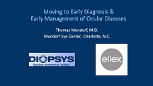 Modernized Glaucoma Management with PERG for Early Detection and SLT for Early Treatment
