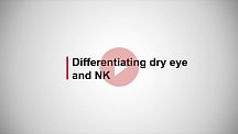 Differentiating dry eye and NK