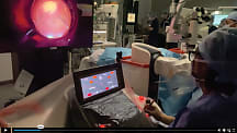 Dr. Fanny Nerinckx performs surgery with the Luca surgical system.