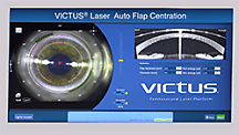 VICTUS® Laser Auto Flap Centration