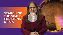Identifying the GA Diagnostic Biomarkers | Julie Rodman, OD, MSc, FAAO