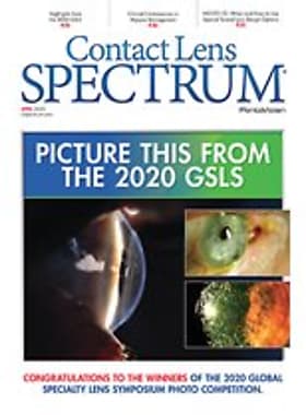 Contact Lens Spectrum