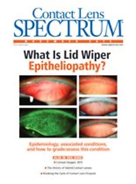 Contact Lens Spectrum