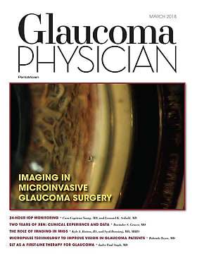 Glaucoma Physician