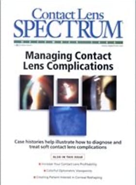 Contact Lens Spectrum