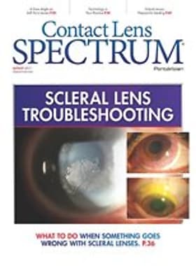 Contact Lens Spectrum
