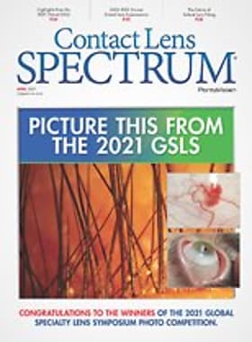 Contact Lens Spectrum