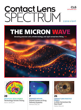 Contact Lens Spectrum