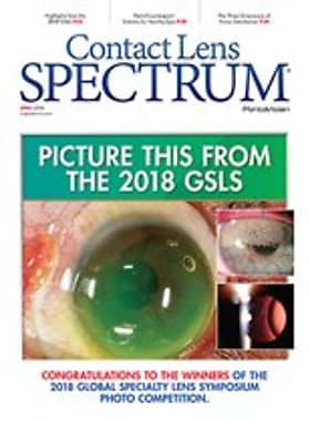 Contact Lens Spectrum
