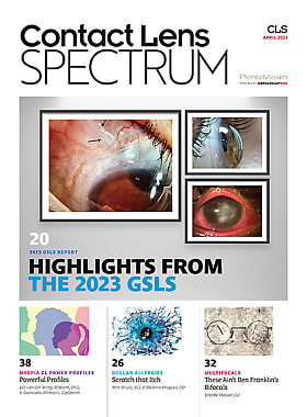 Contact Lens Spectrum